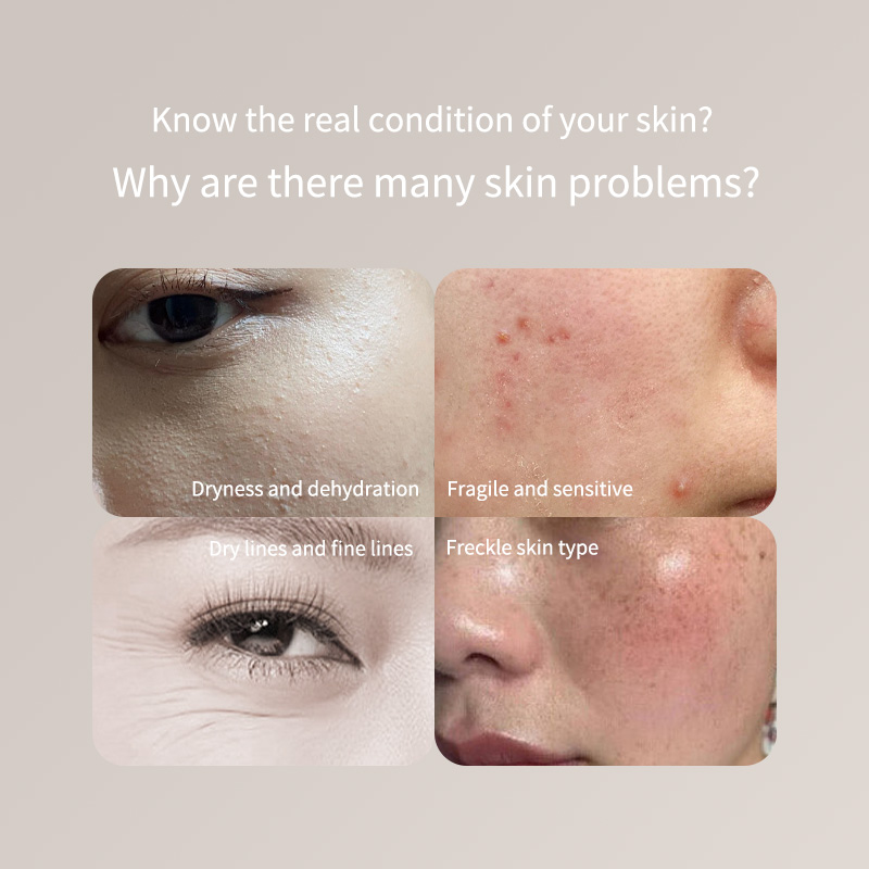 Skincare Only You - Portable Skin Tester Pen - For