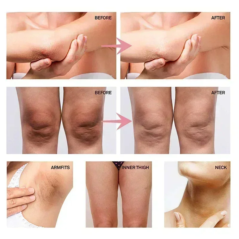 Collagen Underarm Whitening Cr - đánh giá và giá Skincare Whitening