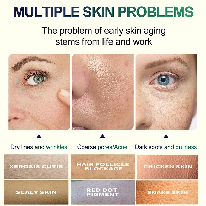 2ND Salicylic Acid Face Facial - đánh giá và giá Glycolic Acid Exfoliant
