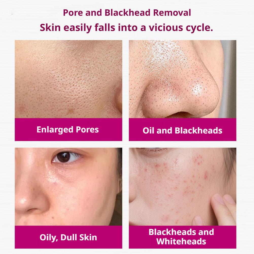 Salicylic Acid Shrink Pores Se - đánh giá và giá Skincare Skintific