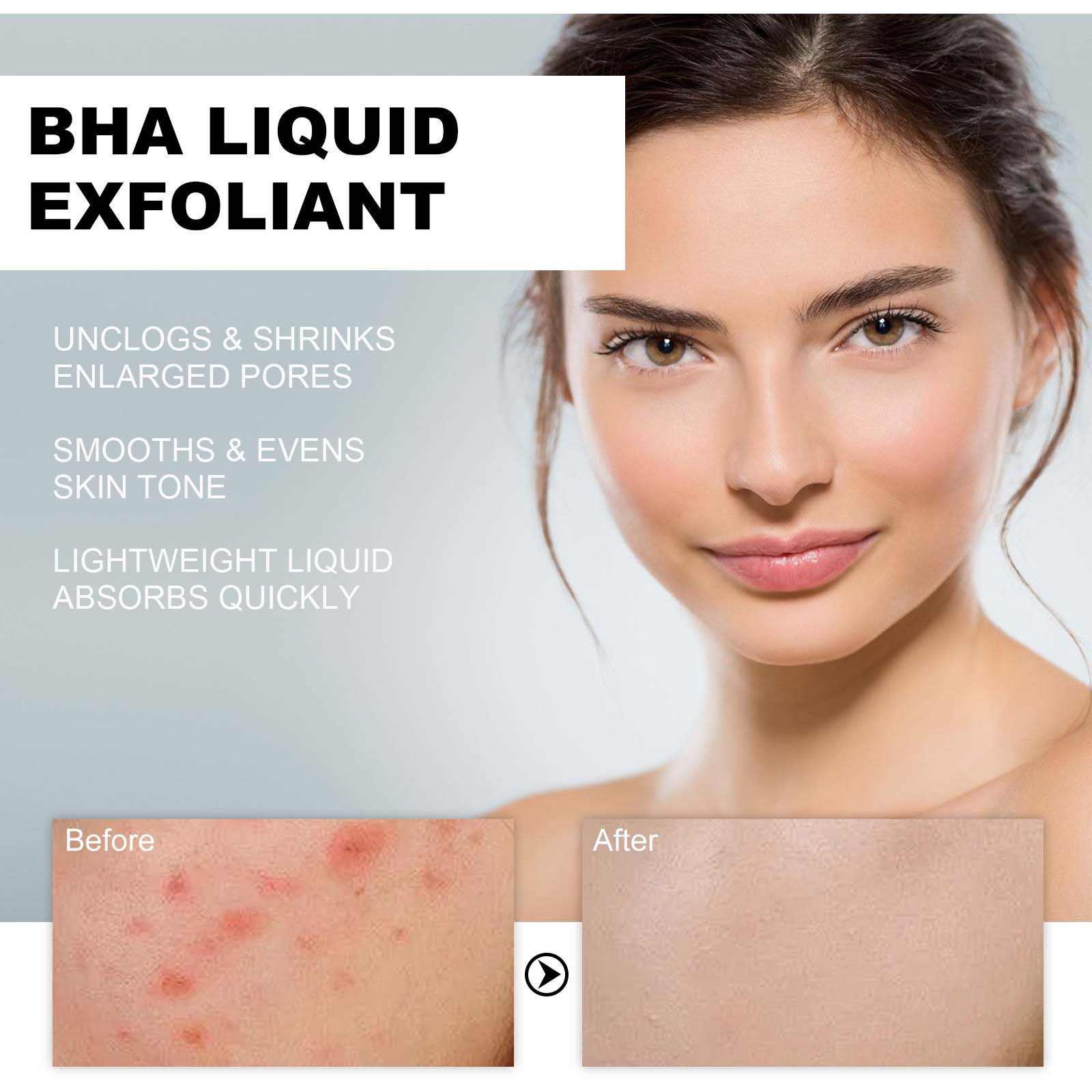 2% Salicylic Acid Liquid Exfol - đánh giá và giá Glycolic Acid Exfoliant