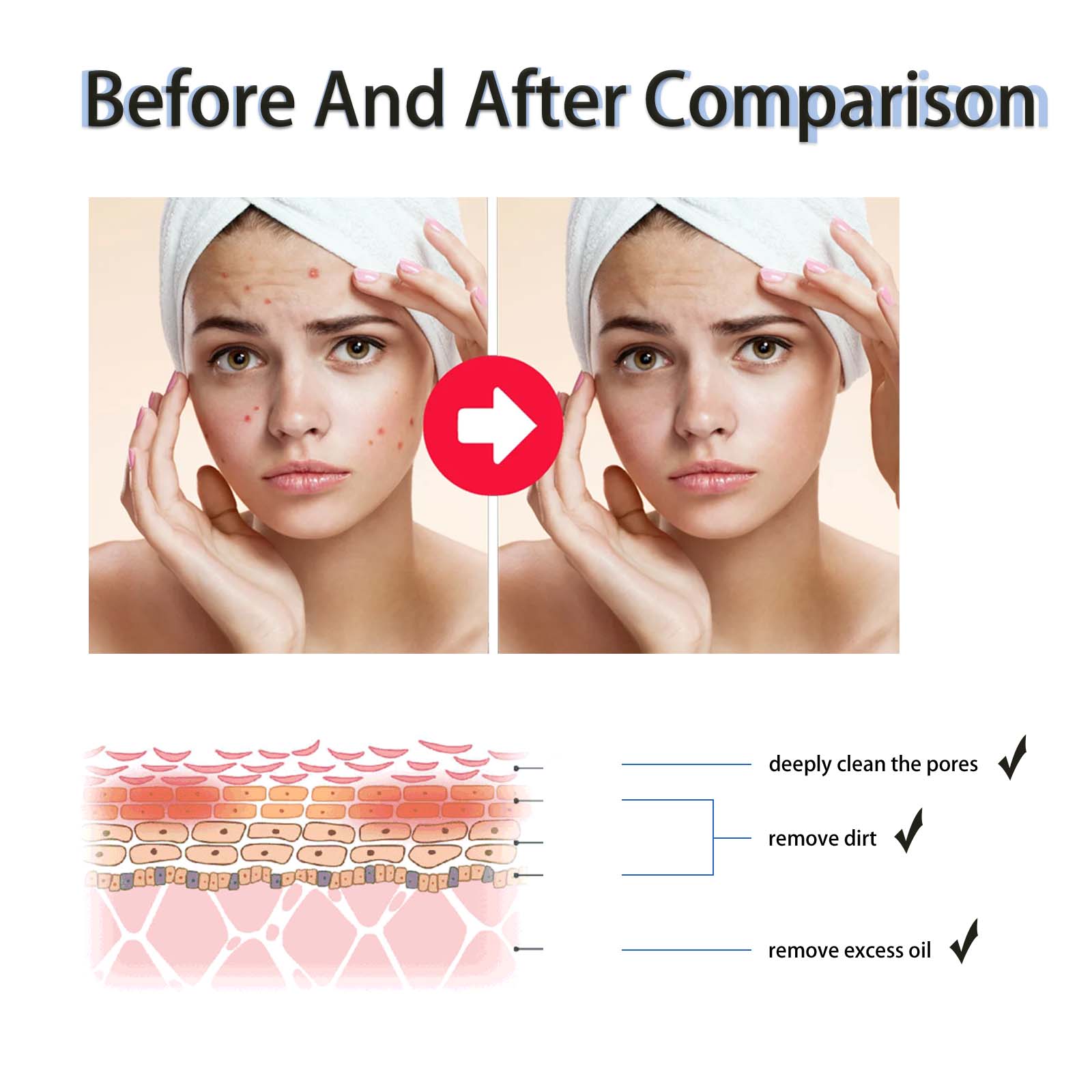 2% Salicylic Acid Liquid Exfol - đánh giá và giá Glycolic Acid Exfoliant