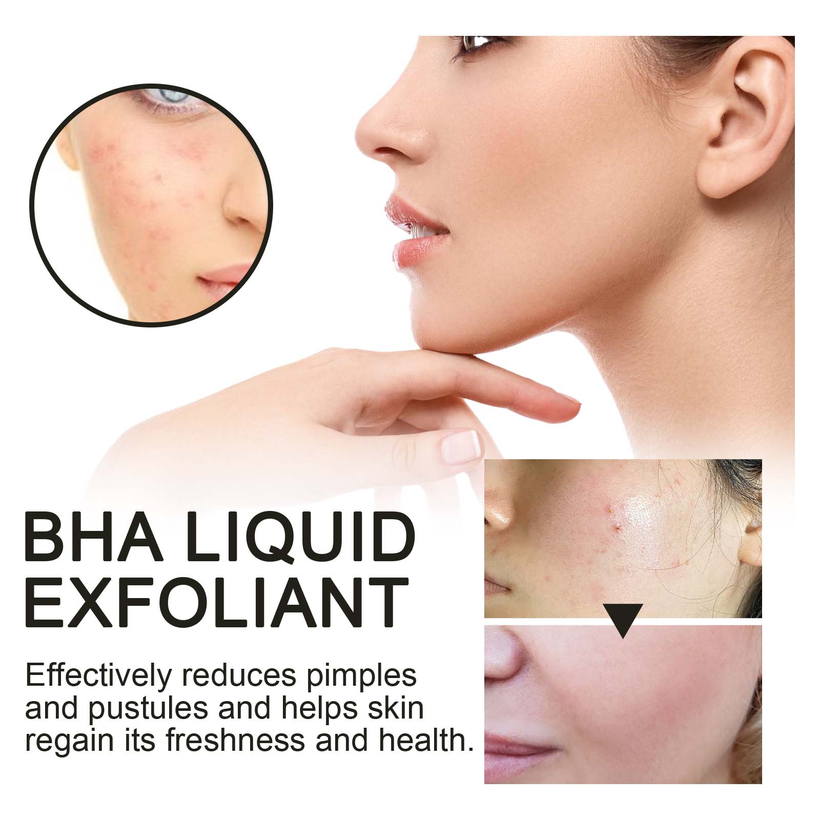 2% Salicylic Acid Liquid Exfol - đánh giá và giá Glycolic Acid Exfoliant