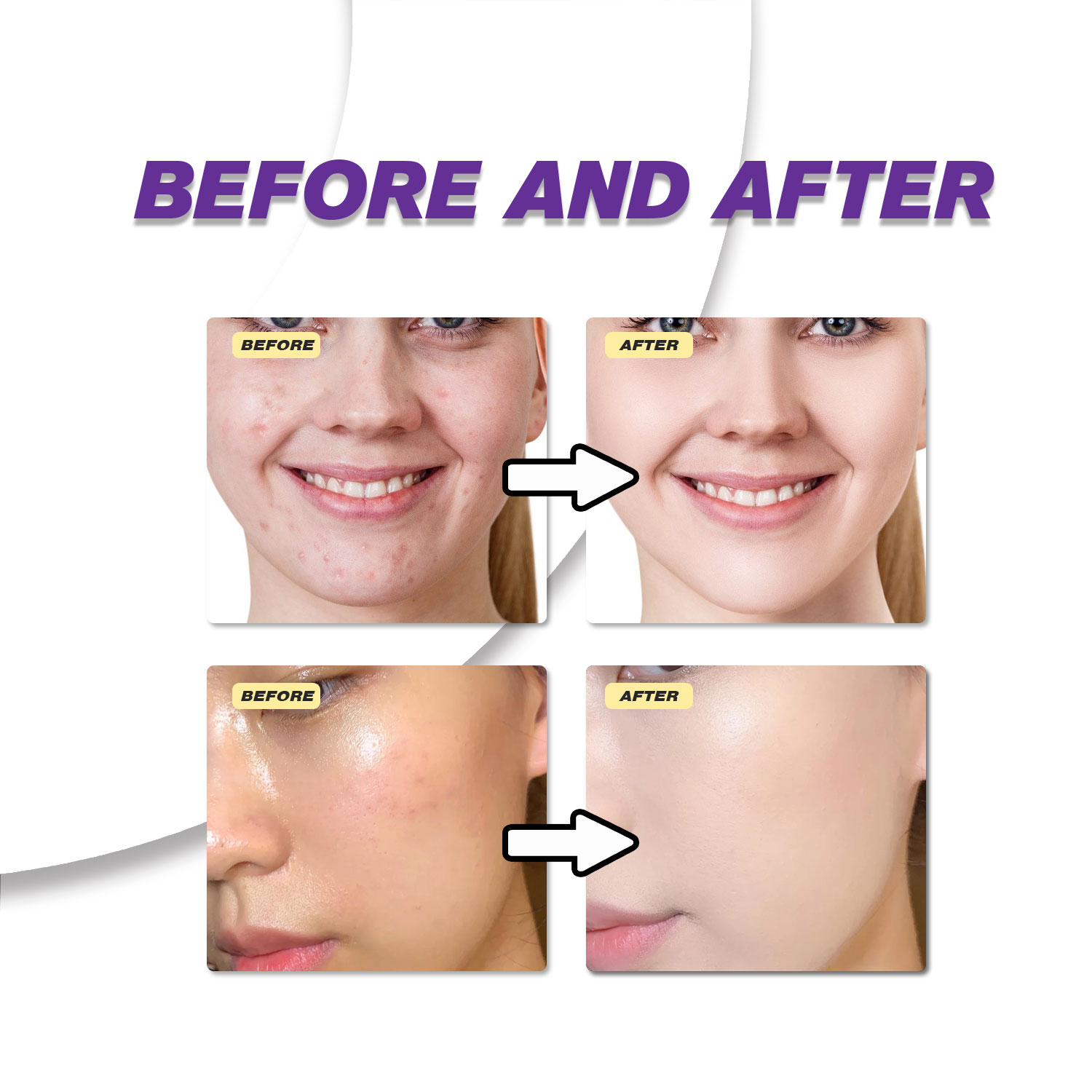 Mild Azelaic Acid Cream Improv - đánh giá và giá Skincare Skintific