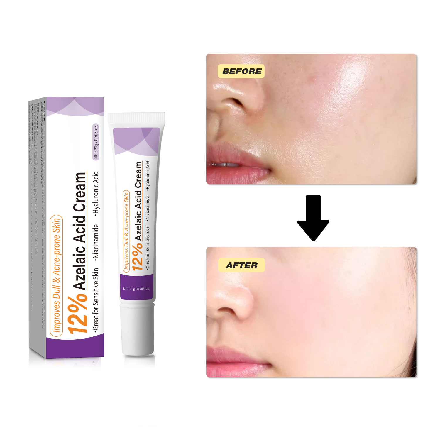 Mild Azelaic Acid Cream Improv - đánh giá và giá Skincare Skintific